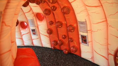 Inflatable colon